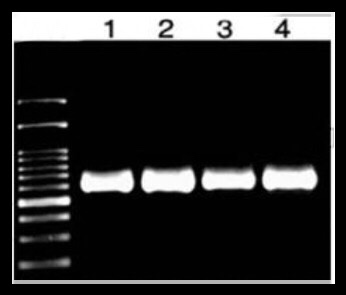 DNA pcr product in gel